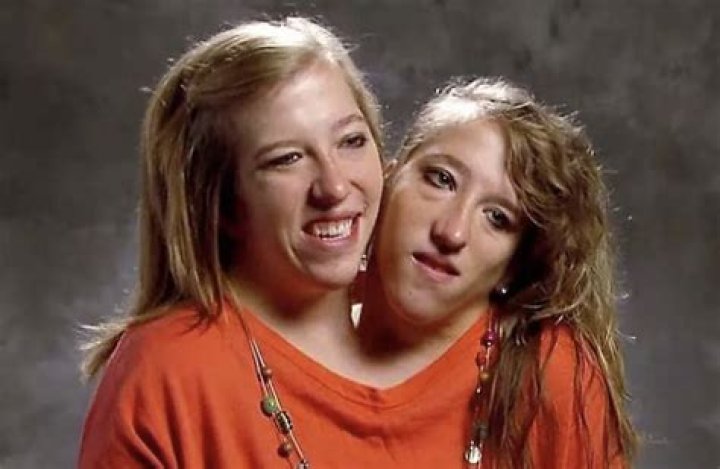 Conjoined twins Abby and Brittany Hensel talk challenge in personal