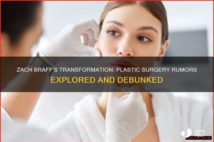 Discover The Truths Behind Zack Braff's Plastic Surgery Journey