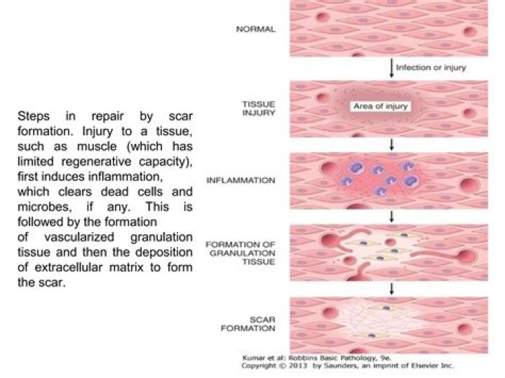 Force Regeneration: The Ultimate Guide To Rapid Tissue Repair