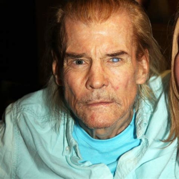 How Did Jan-Michael Vincent Lose His Eye?
