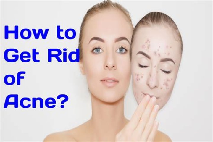 How To Get Rid Of A Gum Dental Abscess Oral Infection On GUMS Instant