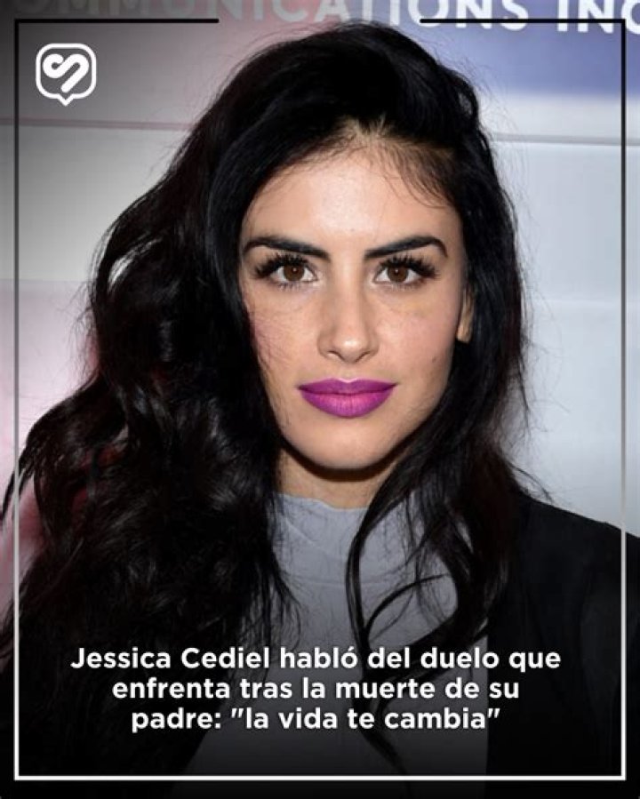 Jessica Cediel habl&oacute; sobre la posibilidad de amputaci&oacute;n por biopol&iacute;meros