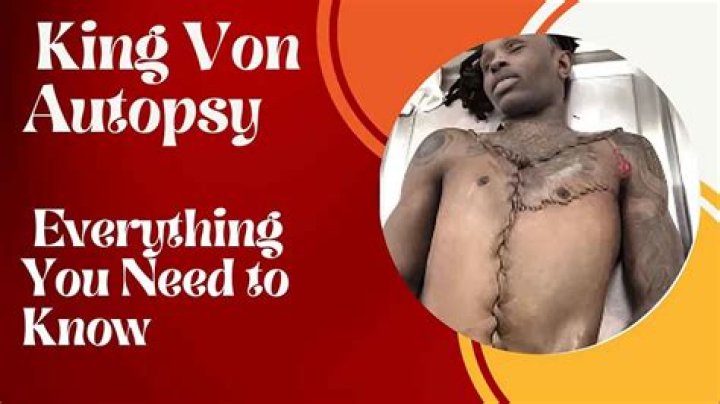 King Von Autopsy Report What Really Happened