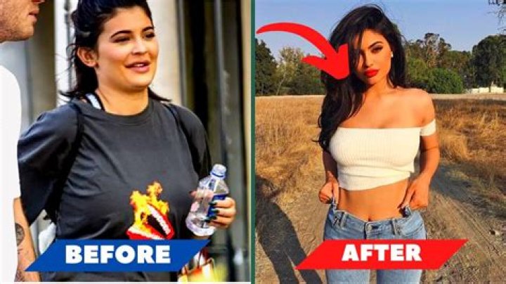 Kylie Jenner's Weight Journey In 2024