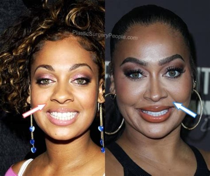 Lala Anthony's Journey Before Surgery