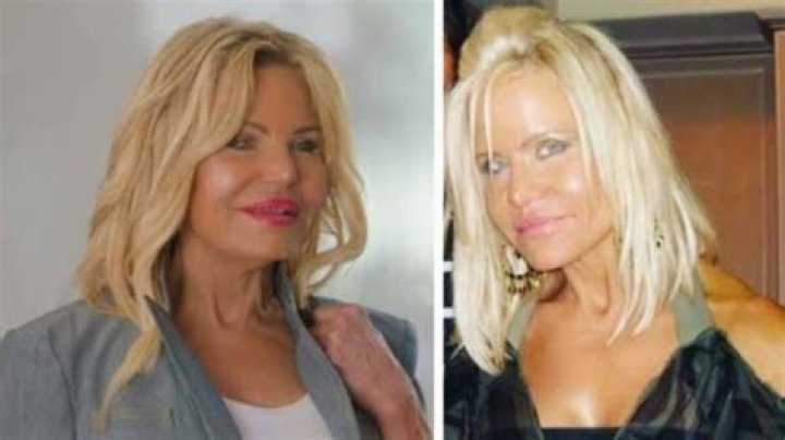 Lisa Helou's Plastic Surgery Journey