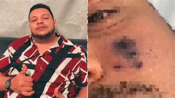 Muere el cantante Darlyn Morais a los 28 a&ntilde;os tras sufrir la picadura