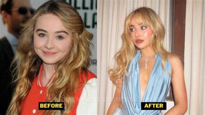 Sabrina Carpenter's Transformation: Before And After Plastic Surgery