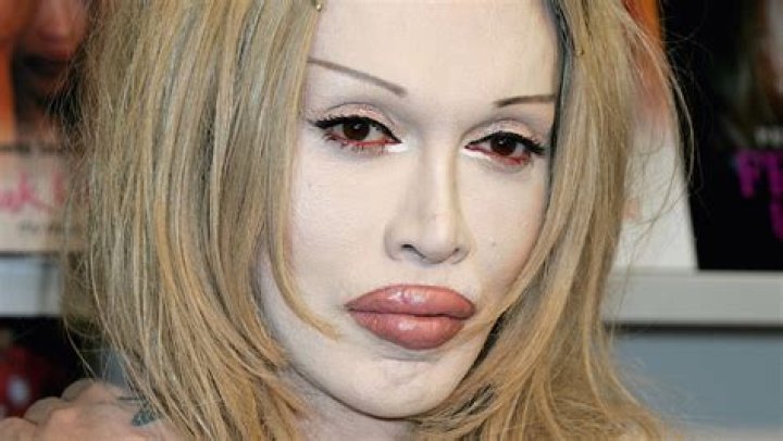 Tragic Details About Pete Burns