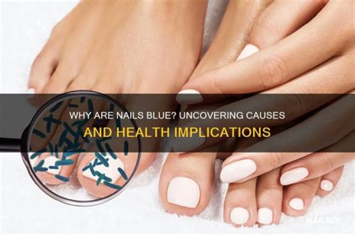 Uncovering Causes, Treatments, And Implications