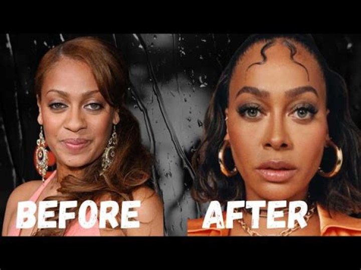 Unveiling Lala Anthony's Transformation: Discoveries Before Plastic Surgery