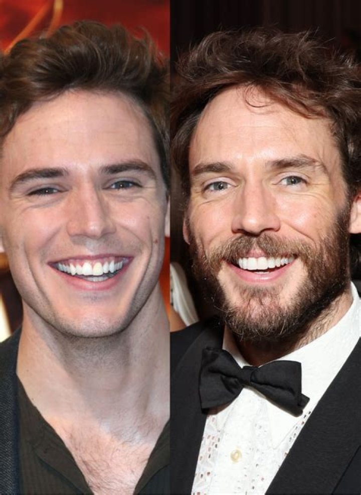 Unveiling Sam Claflin's Teeth Transformation: A Journey Of Smiles