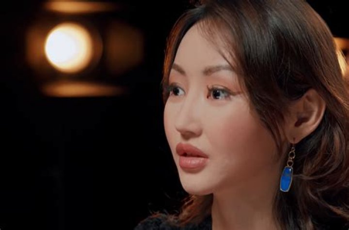 Unveiling The Complexities Of Yeonmi Park's Plastic Surgery Journey: Discoveries And Insights