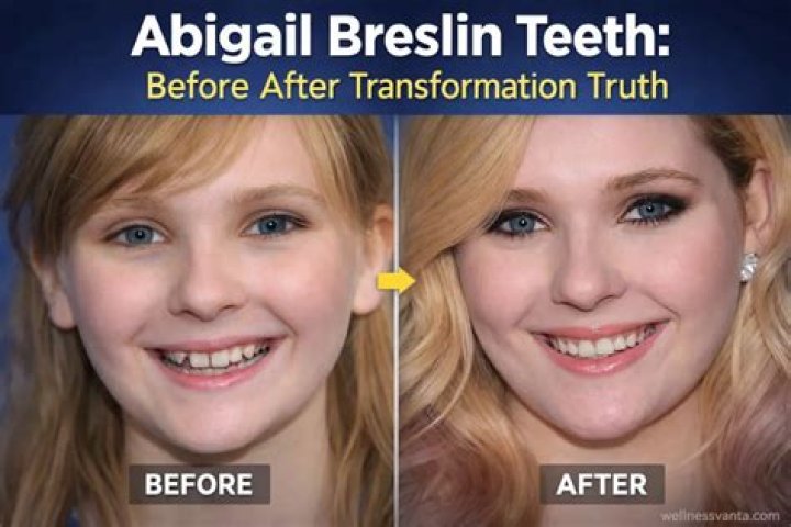 Unveiling The Truths Behind Abigail Breslin's "Bad Teeth": Discoveries And Insights
