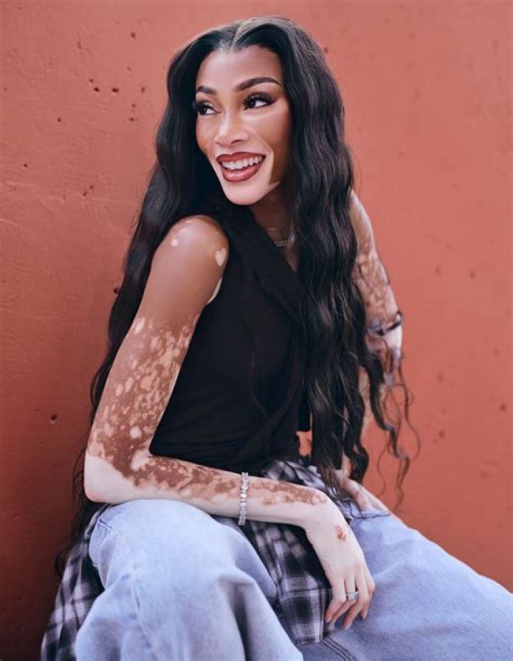Winnie Harlow Opens Up About Early Days of Dating Kyle Kuzma