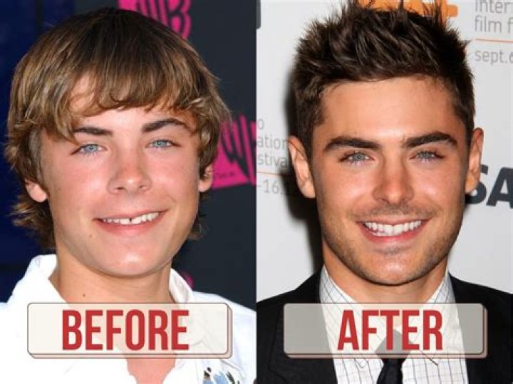 Zac Efron &lsquo;almost died&rsquo; after shattering his jaw CNN